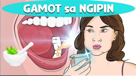 pinakamabisang gamot sa coryza|Gamot Sa Sakit Ng Ngipin: Ano Ba Ang Mabisang .